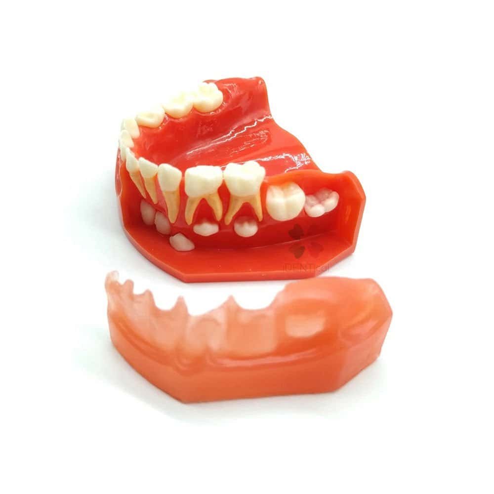 Removable denture model with artificial teeth for dental practice and patient education.