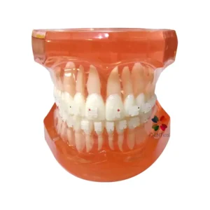 Complete Ceramic Bracket Model MD-121