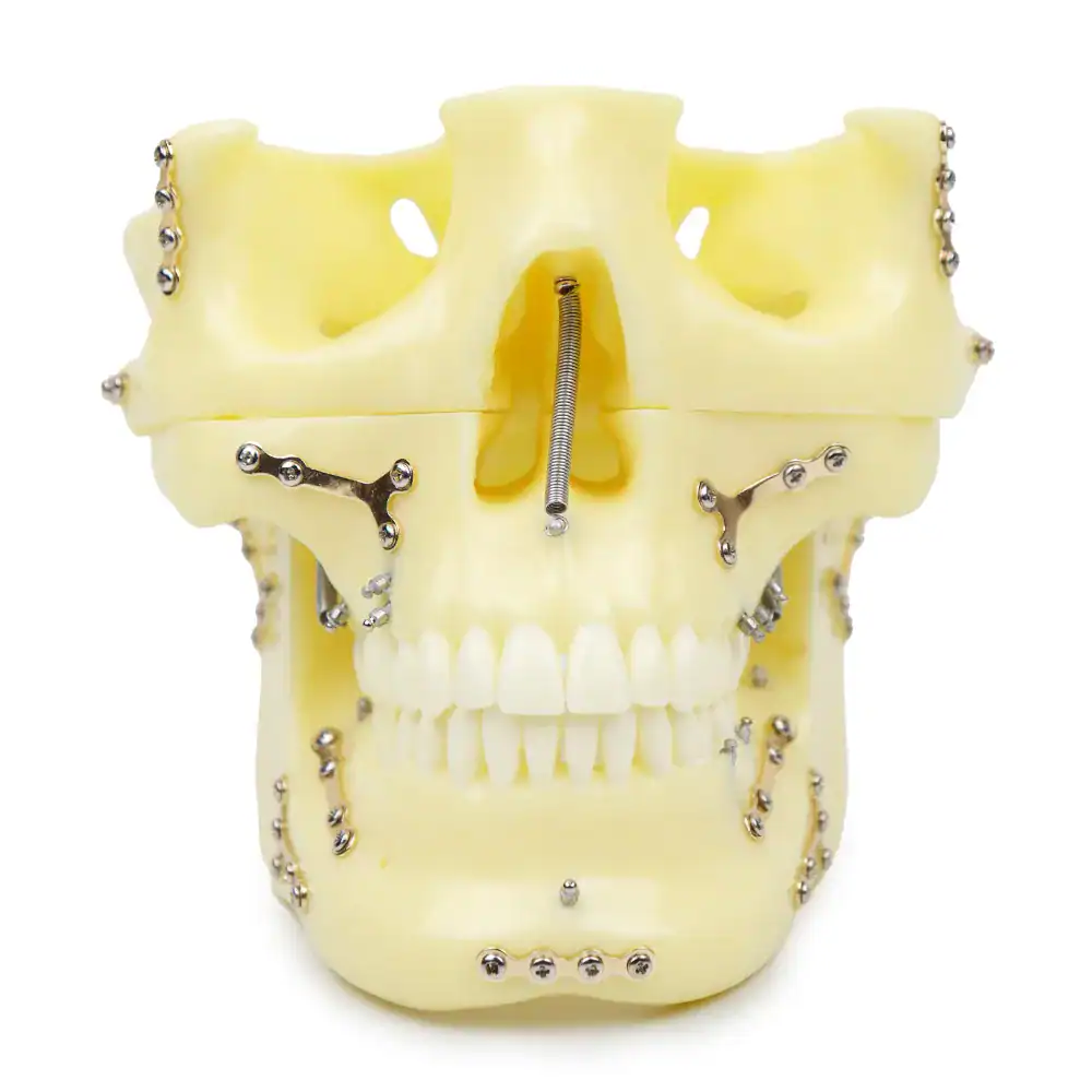 Orthodontic implant model demonstrating dental hardware and jaw structure for dental training.